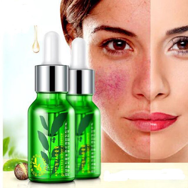 Tinh chất serum trà xanh Rorec Bioaqua giúp da Trắng Sáng - Lành Mụn - Căng Mịn Trong Suốt