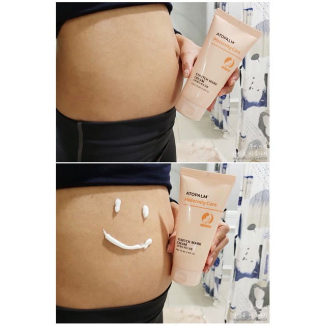 Kem trị rạn da bà bầu hiệu quả ATOPALM Maternity Care Stretch Mark Cream 150ml