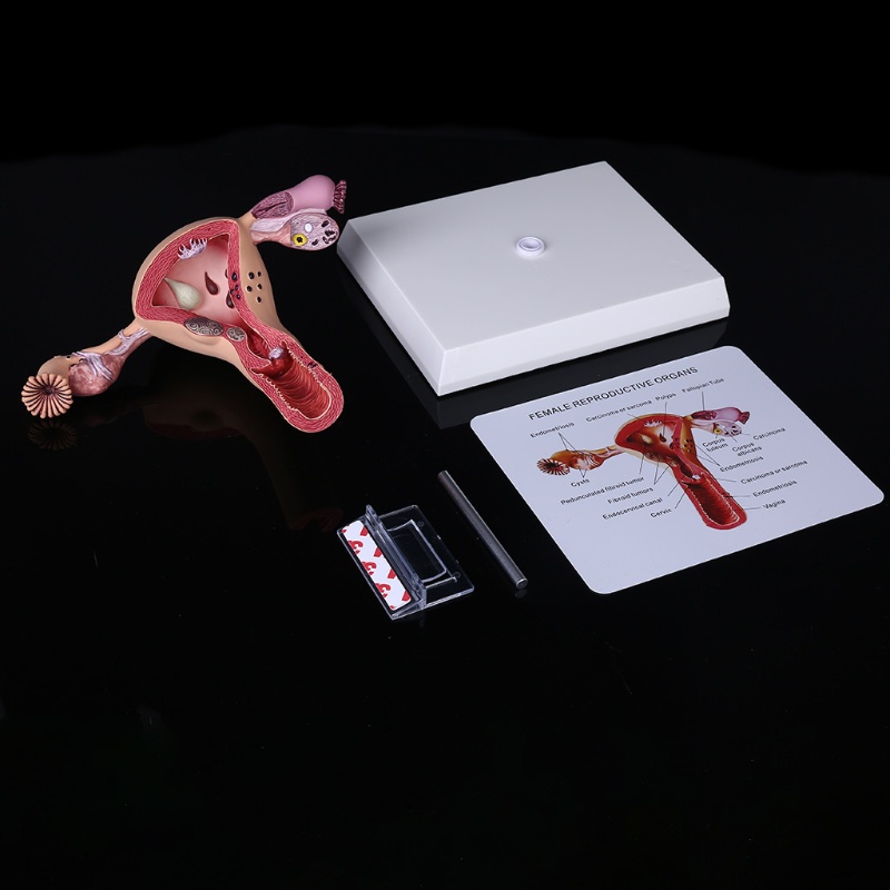 Mô Hình Lối Đi Bệnh tật Bằng Tiếng Ồn Người Phụ Nữ Uterus