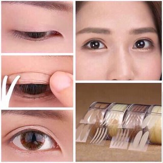 Kích mí lưới cuộn tim cuộn 300 đôi