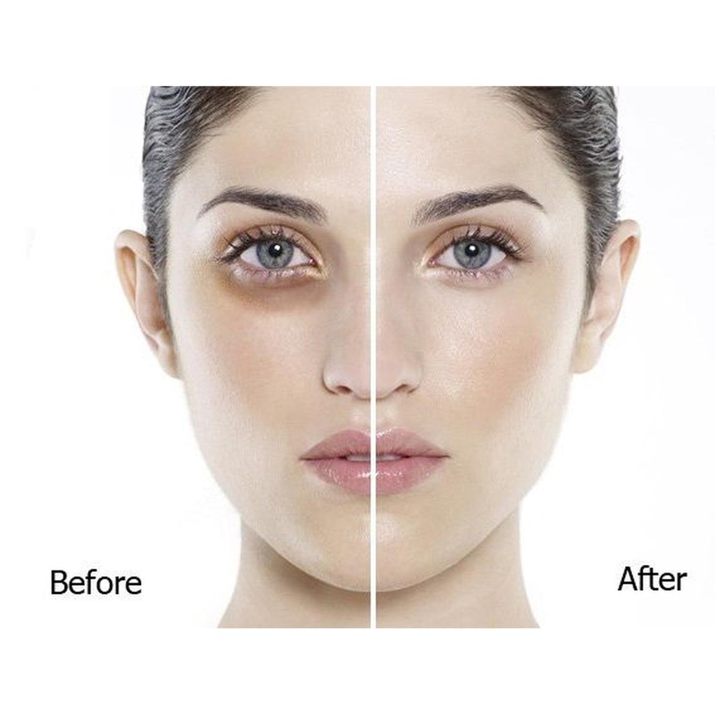 Kem dưỡng nâng cơ và giảm quầng thâm mắt Secret Key Starting Treatment Eye Cream 30ml