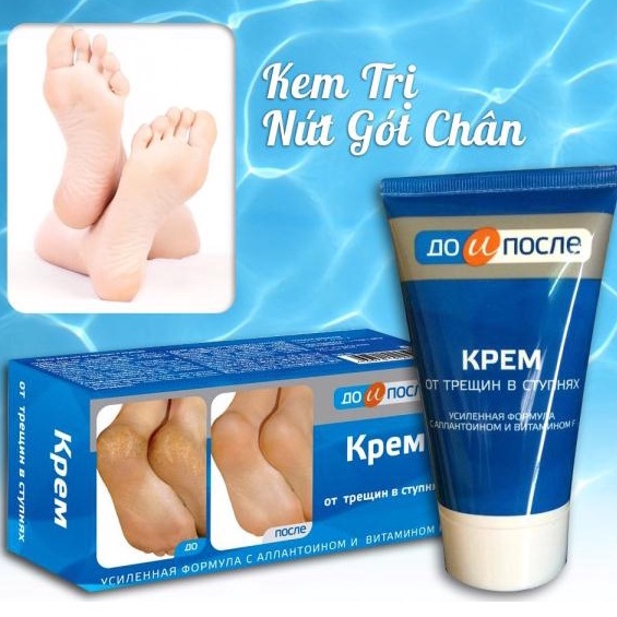 Kem Giảm Nứt Gót Chân Kpem Nga - 50ml