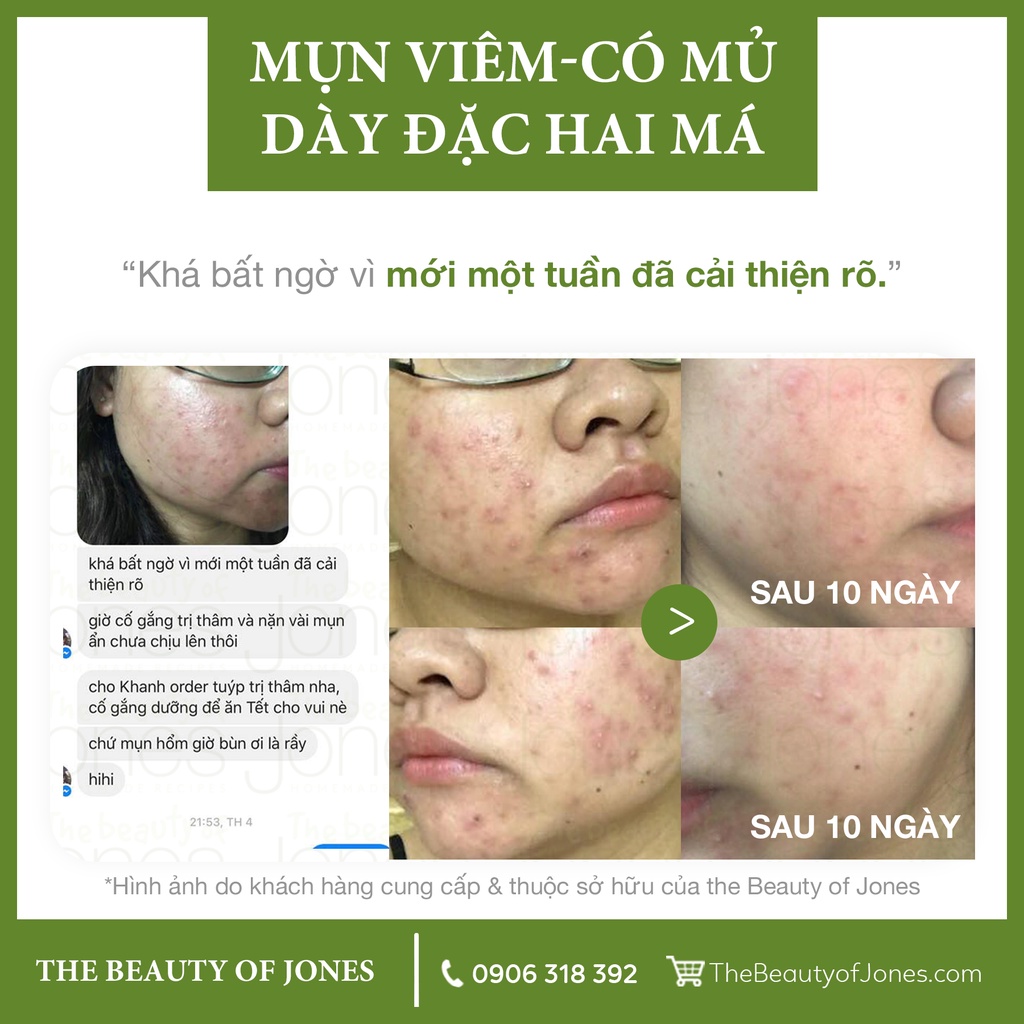 Combo làm sạch và chống nắng cho da dầu The Beauty of Jones