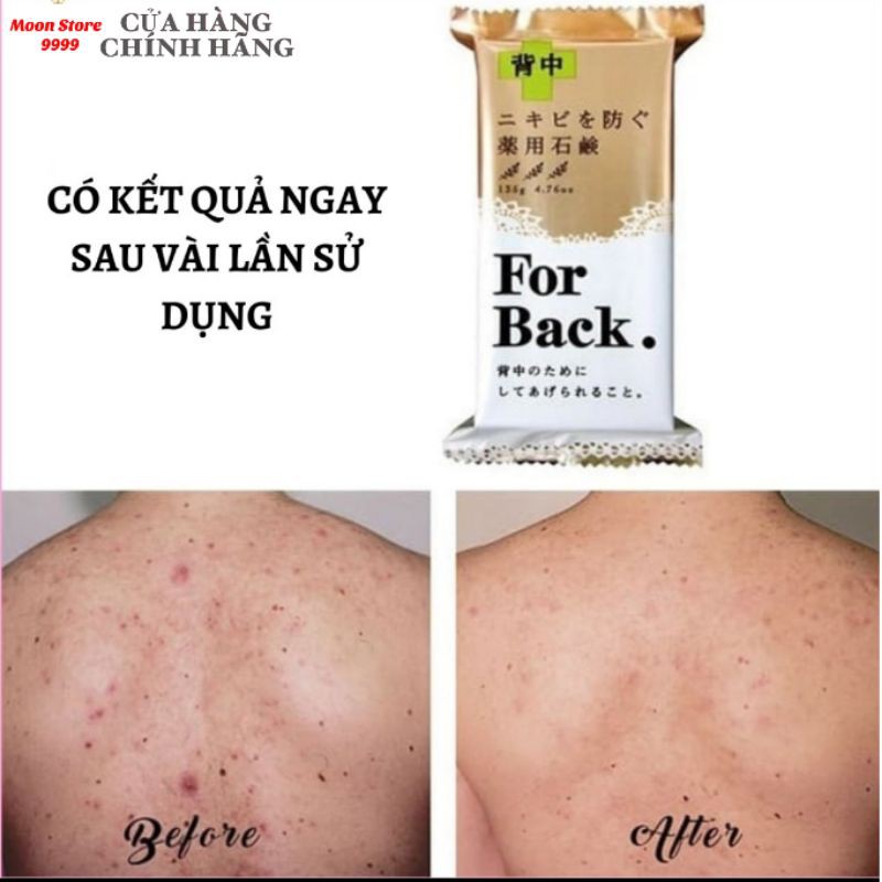 Xà phòng For Back Pelican Nhật Bản - giảm mụn lưng, thâm mụn sau 2 tuần