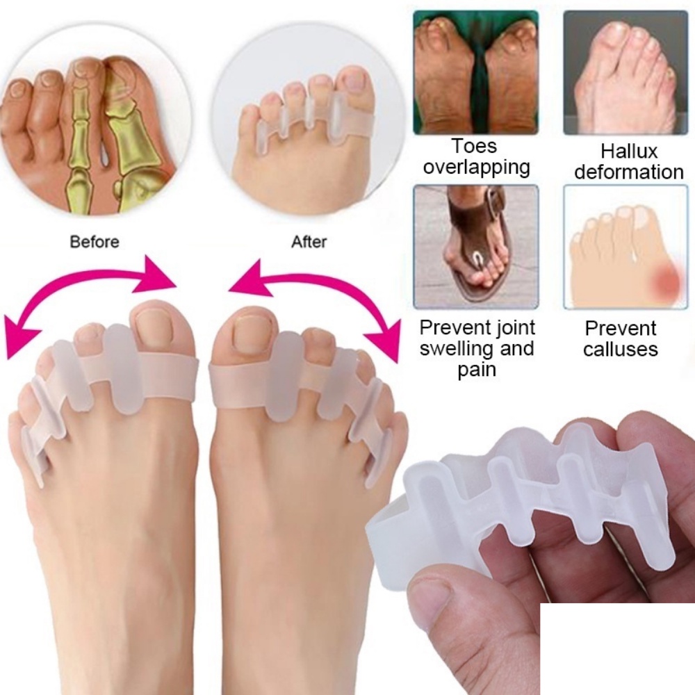 Dụng cụ tách ngón chân cái halgus định hình bàn chân thẳng chứng vẹo ngón dành cho tập luyện chăm sóc bàn chân SA30