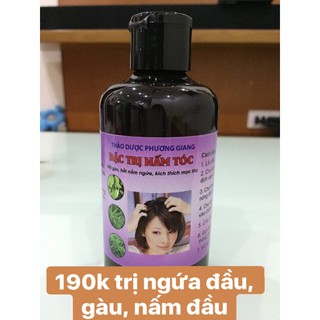 trị nấm tóc nhà thuốc gia truyền Phương Giang