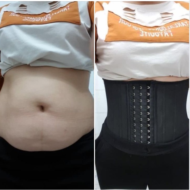 Đai nịt bụng giảm mỡ latex 25 xương. Đảm bảo chất lượng! | BigBuy360 - bigbuy360.vn