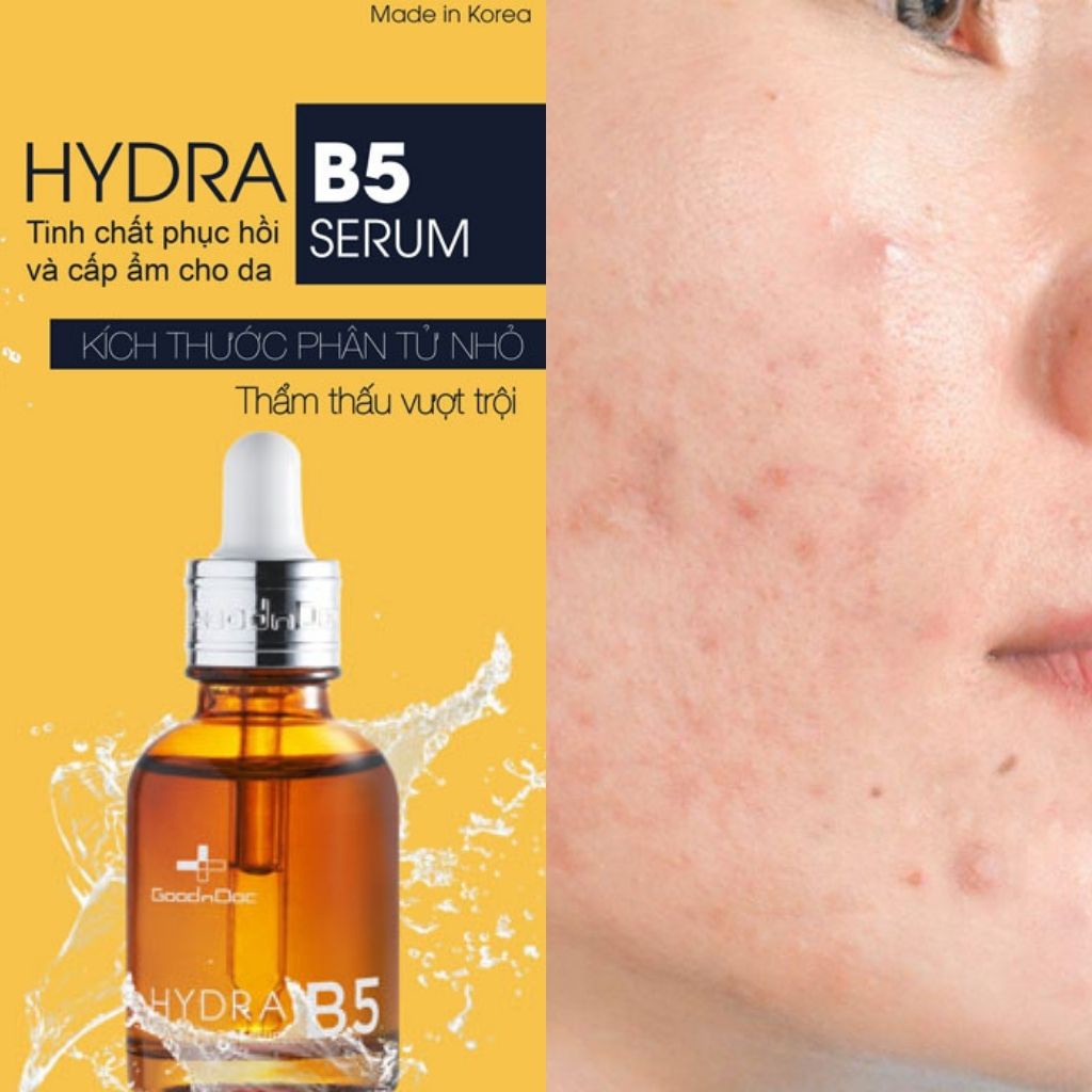 Tinh Chất Dưỡng Ẩm, Phục Hồi Da Goodndoc Hydra B5 Serum 30ml