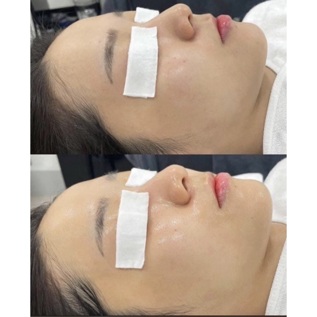 [Chính Hãng CTY] Mask cấp nước và phục hồi chuyên sâu - 𝐌𝐚𝐬𝐤 𝐂𝐢𝐯𝐚𝐬𝐚𝐧 𝐇𝐲+ 𝐁𝐚𝐥𝐬𝐚𝐦 𝐏𝐨𝐰𝐝𝐞𝐫 [tặng kèm muỗng khuấy]