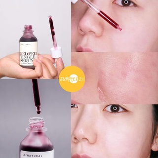 Tinh Chất Peel Da SO'NATURAL RED PEEL 35ML