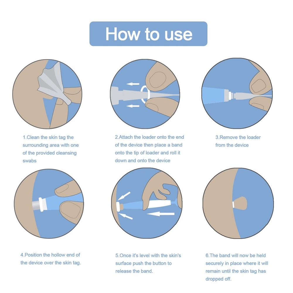 Mới Dụng Cụ Loại Bỏ Mụn Thịt Trên Da Tự Nhiên Không Gây Đau