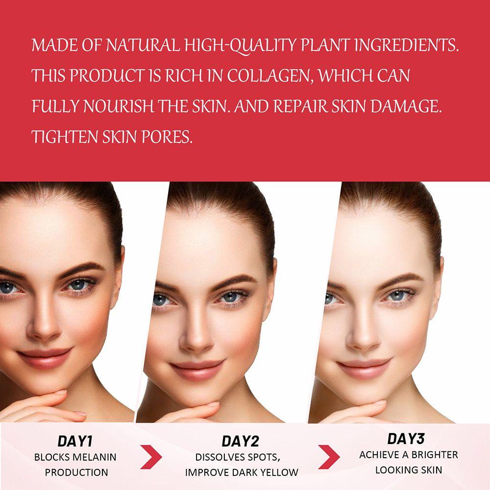 Kem Dưỡng Ẩm Làm Trắng Da Kojic Acid 3 Ngày