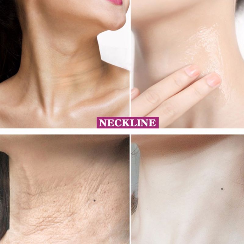 XIXI Kem dưỡng da cổ 40g chống nếp nhăn làm trắng dưỡng ẩm và ngăn ngừa lão hóa
 | BigBuy360 - bigbuy360.vn