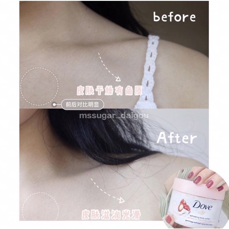 [BẢN ĐỨC] Tẩy da chết toàn thân Dove Exfoliating Body Scrub | BigBuy360 - bigbuy360.vn