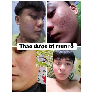 Tái Tạo Da MT (50ml)