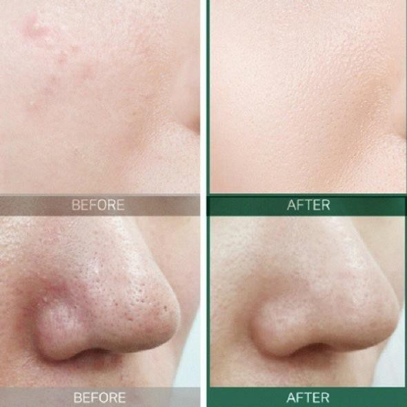 Hàng Hàn- Nước Hoa Hồng Toner Some By Mi AHA-BHA-PHA 30 Days Miracle Toner 150ml