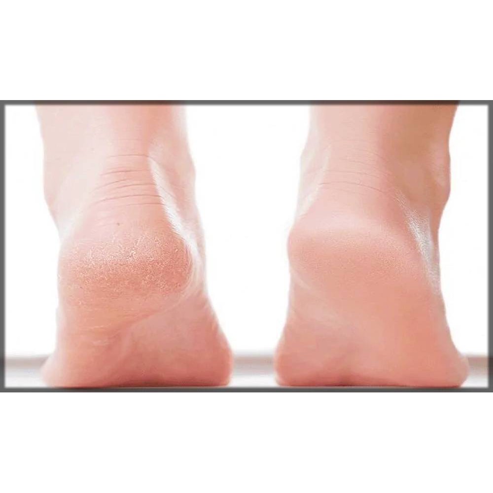 EUCERIN KEM DƯỠNG DA CHÂN VÀ CẢI THIỆN NỨT GÓT CHÂN Intensive Repair Foot Creme Fragrance Free 10% 85gr (Bill Mỹ) | BigBuy360 - bigbuy360.vn