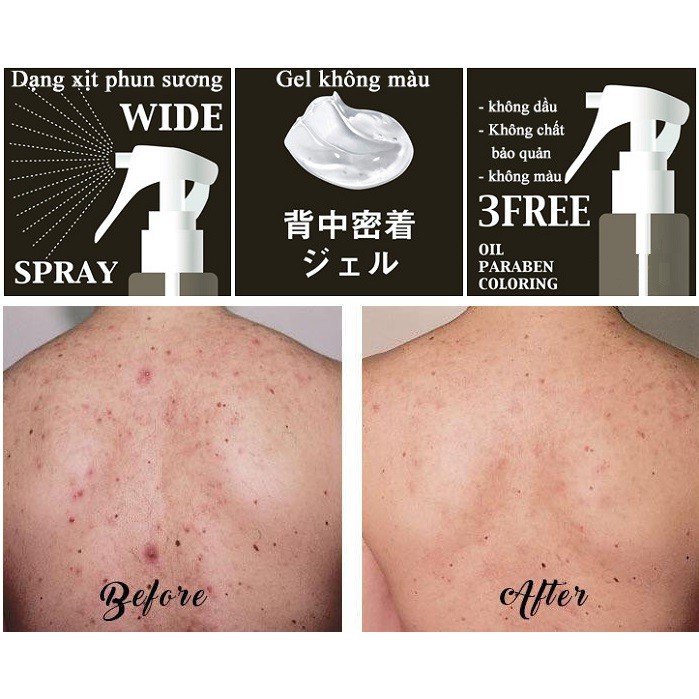 Combo 2 Sản Phẩm Giảm Mụn Lưng Pelican For Back (Xà Phòng Medicated Soap 135g + Xịt Gel Mist 100ml) | BigBuy360 - bigbuy360.vn