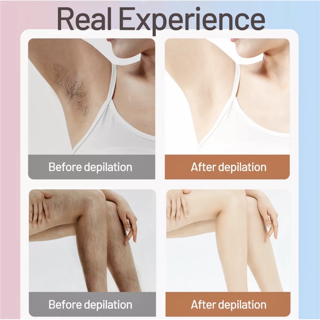 Máy triệt lông vĩnh viễn tại nhà IPL 999.900 xung