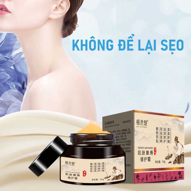 Kem loại bỏ sẹo Kem trị mụn da mặt Kem trị mụn trị mụn trứng cá Trị mụn đầu đen Kem làm trắng da vết rạn da Loại bỏ mụn