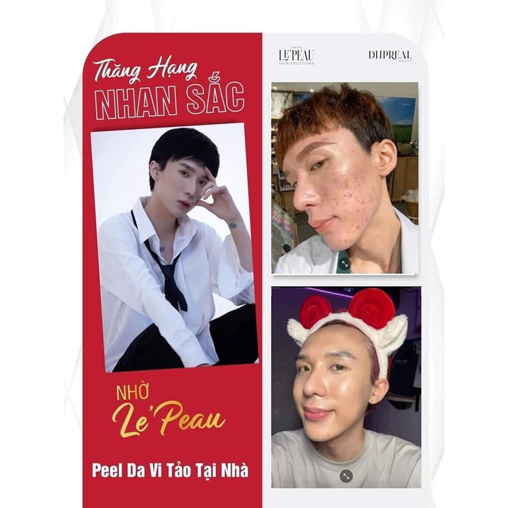 Peel Da Retinol Vi Tảo Le'Peau - Tinh Chất Peel Da Sinh Học