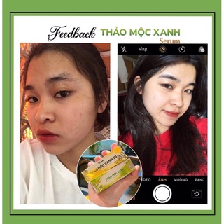 [SẴN HÀNG] SERUM THẢO MỘC XANH 5ml