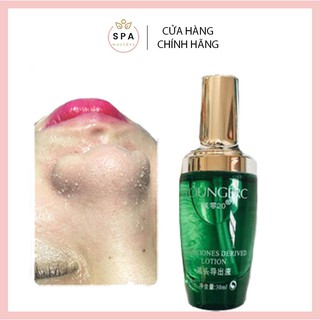 Ủ Mụn YOUNGERC Chính Hãng Tinh Chất Loại Bỏ Mụn Đầu Đen Mụn Cám