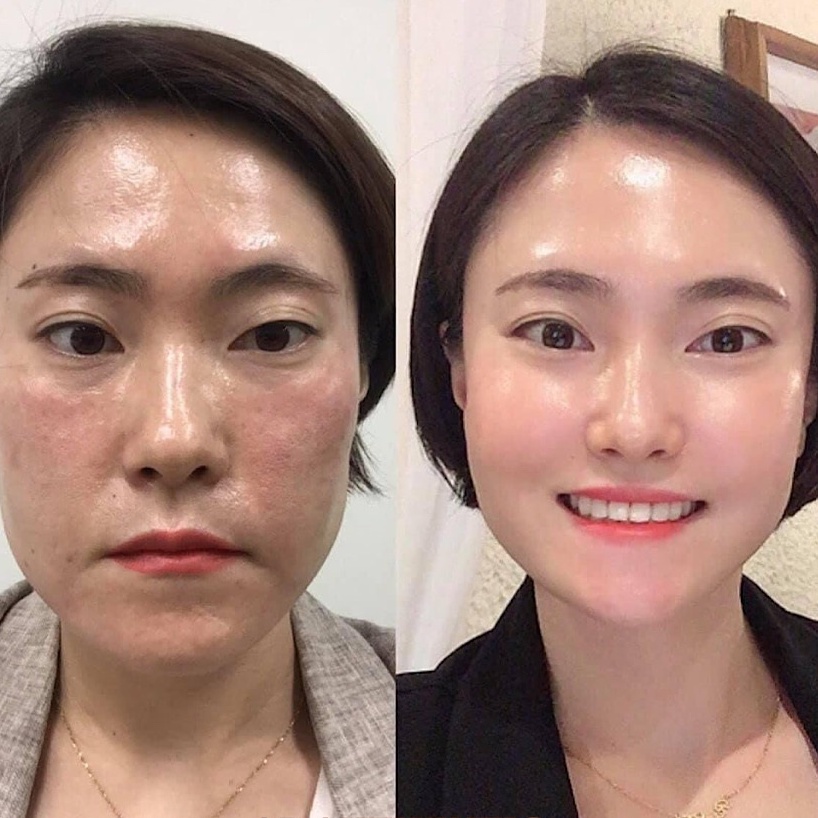 [HOT] Lọ Peel da giúp tái tạo da chuyên sâu, mờ sạm nám, căng bóng da - CNP Rx Skin Rejuvenating Intensive Peel