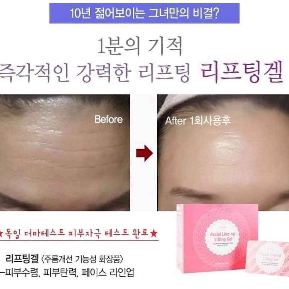 Tách lẻ Gel Nâng Cơ Xóa Nhăn CareCella Facial line up lifting gel 1 hộp/4 gói x 9ml