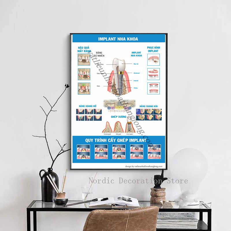 TRANH TƯ VẤN NHA KHOA CHỦ ĐỀ '' IMPLANT NHA KHOA''