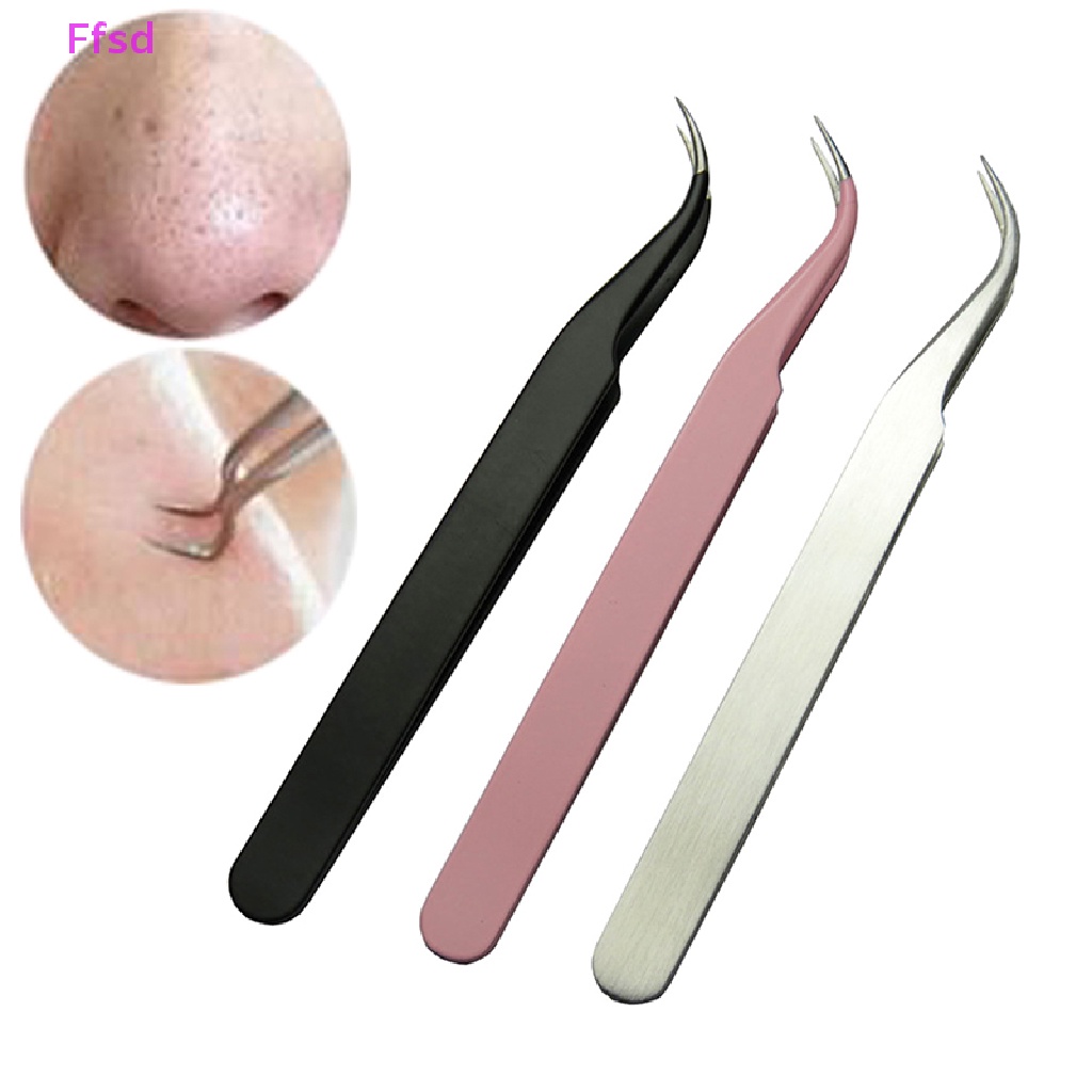Nhíp Nặn Mụn Đầu Đen Bằng Thép Không Gỉ