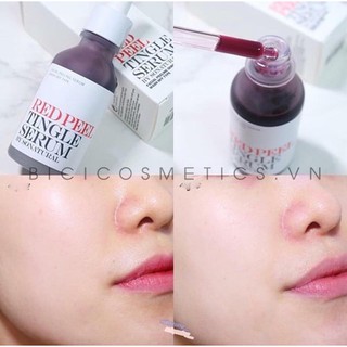 Serum Red Peel Tingle Serum -So’Natural
