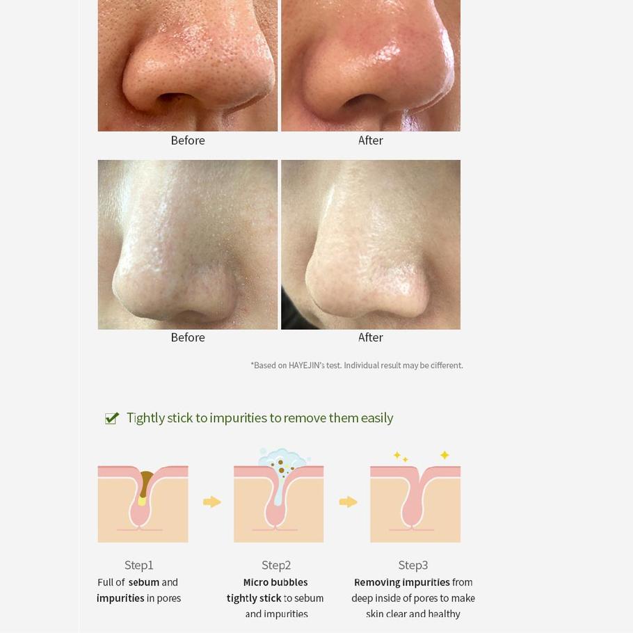 Sữa Rửa Mặt Mầm Mầm 170ml Hayejin | BigBuy360 - bigbuy360.vn