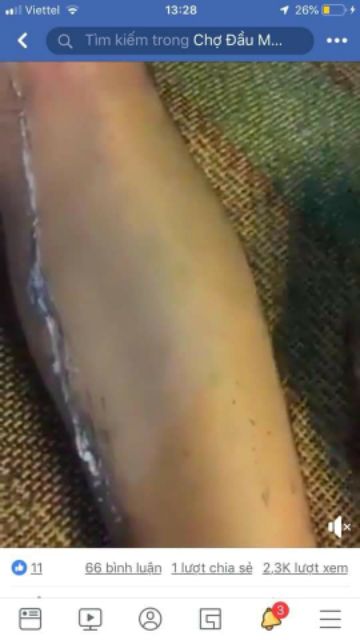 (Tặng serum cao triệt) Combo Kem Triệt Râu Ria, Lông Vĩnh Viễn Không Mọc Lại | BigBuy360 - bigbuy360.vn