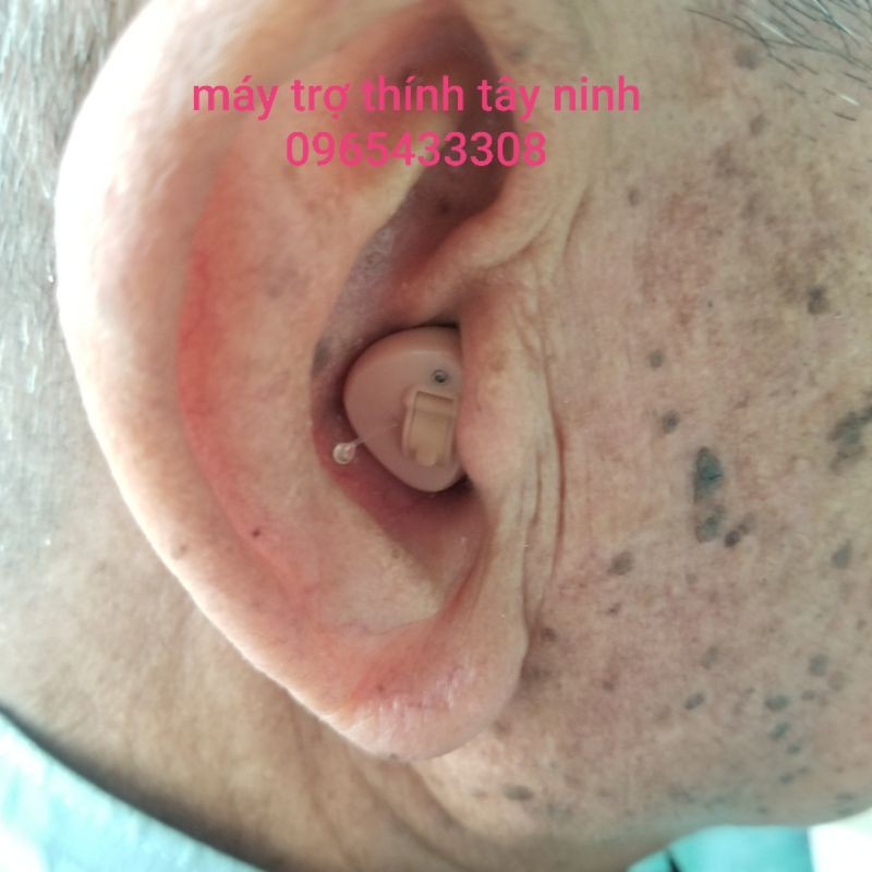 Máy trợ thính siêu nhỏ.