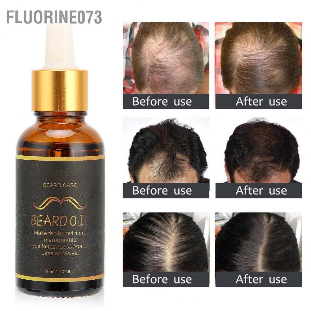 [Hàng mới về] Tinh chất hỗ trợ mọc râu dành cho nam 30ml