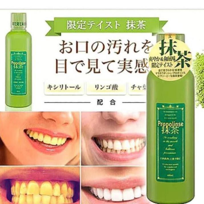 Nước súc miệng Propolinse Nhật Bản 600ml sạch răng, ngừa hôi miệng, hơi thở thơm tho chỉ với 30s