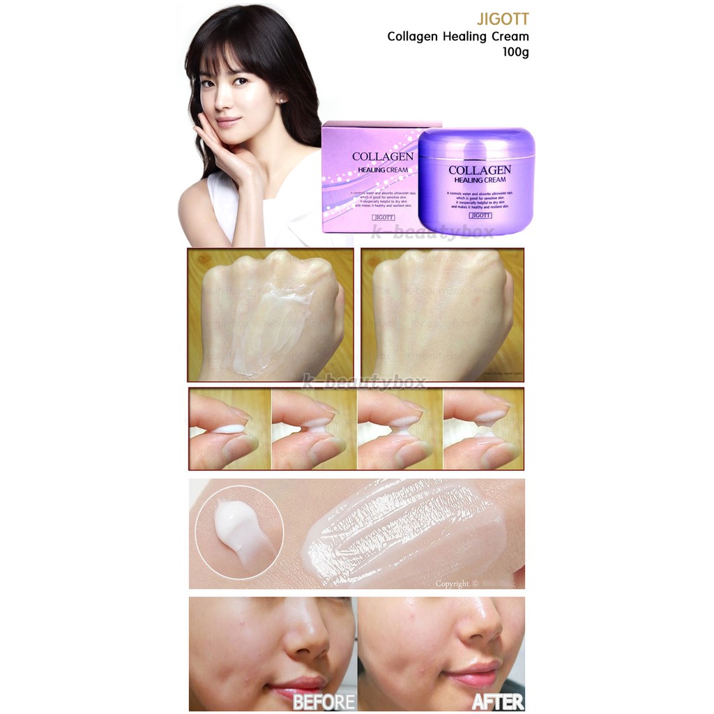 Kem dưỡng da chuyên sâu Jigott Collagen Healing Cream 100ml