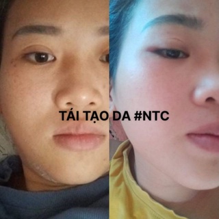 tái tạo da nhanh NTC