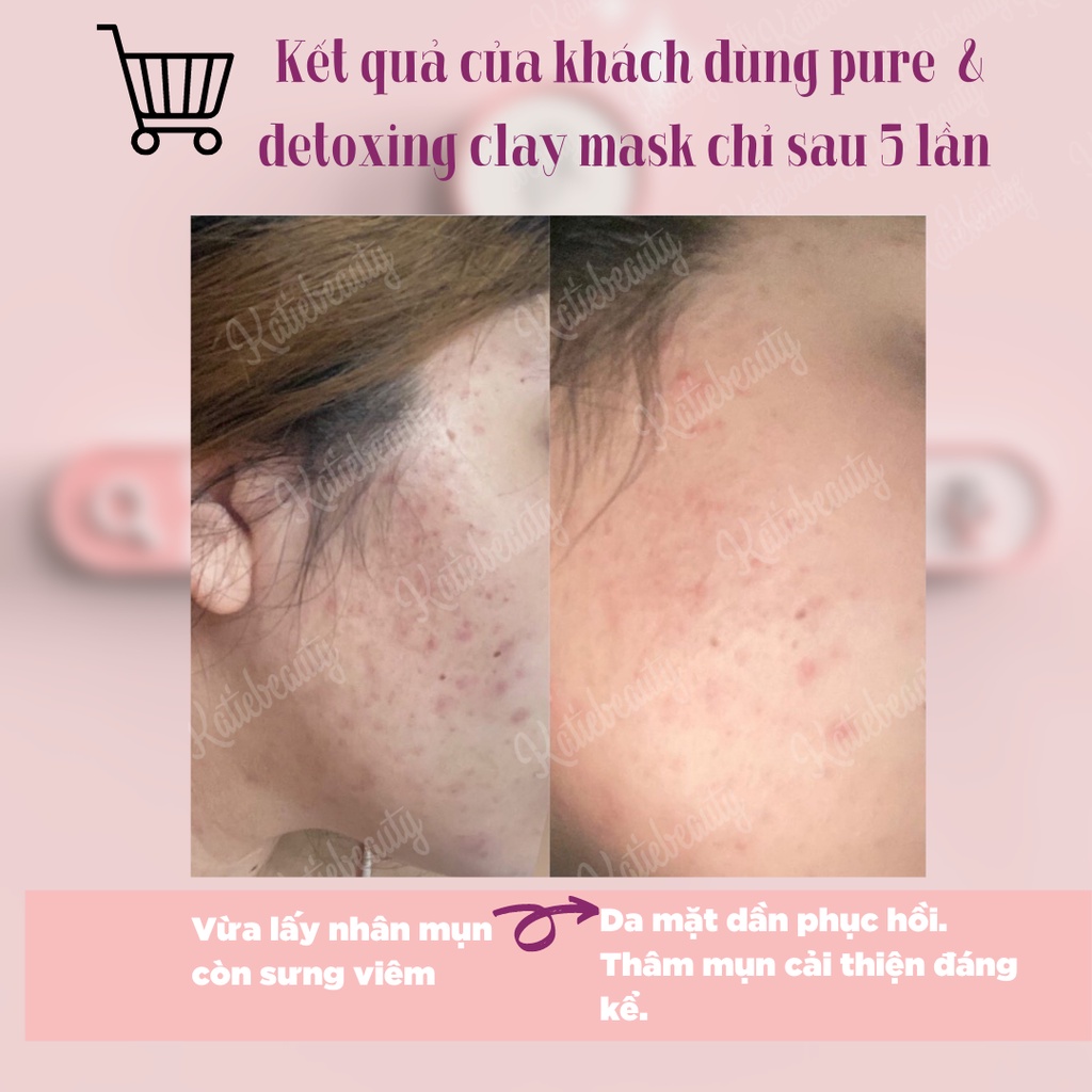 Mặt nạ đất sét trắng da, detoxing lỗ chân lông Pure, Detoxing Clay Mask 80g | KATIEBEAUTY