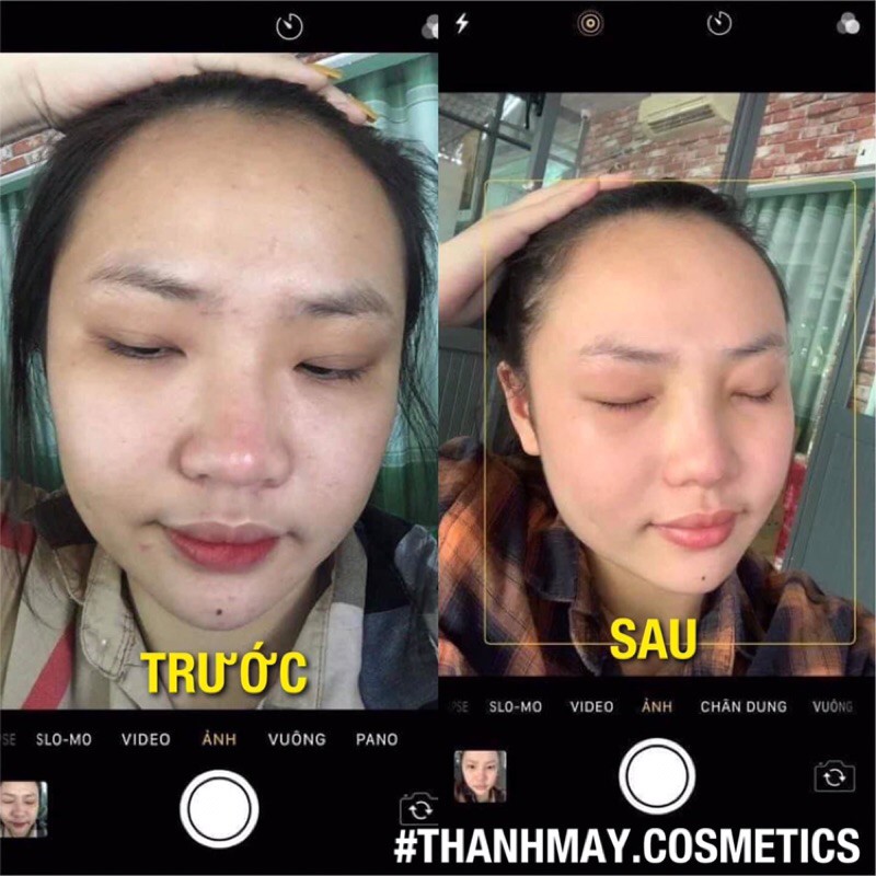 [HÀNG CHÍNH HÃNG] FACE TRẮNG DA MÂY CREAM | BigBuy360 - bigbuy360.vn