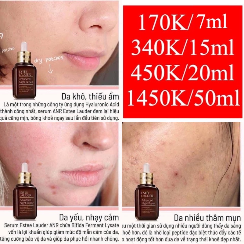 Estee Lauder Tinh chất dưỡng da