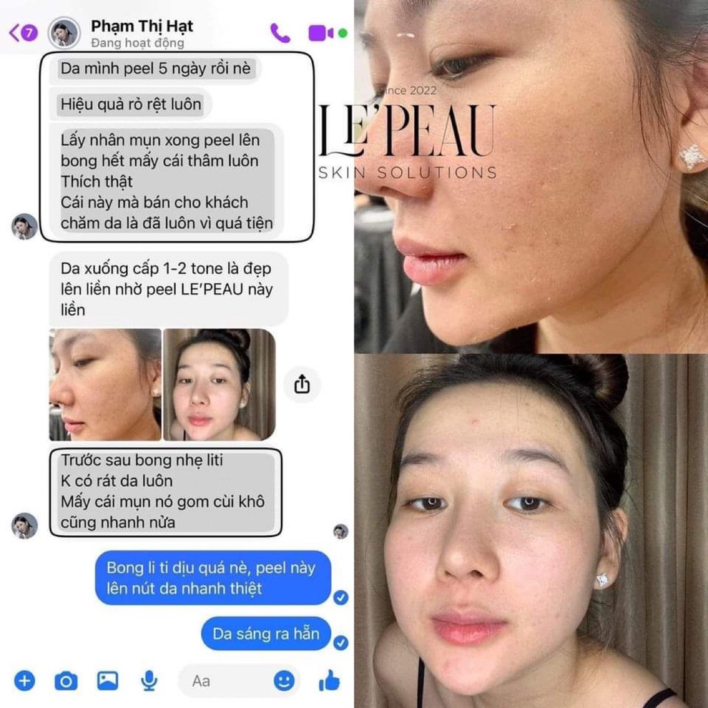 Peel Da Retinol Vi Tảo LE PEAU, Tinh Chất Tái Tạo Da Sinh Học Căng Bóng, Tặng Kèm Serum B5 Phục Hồi - 10ml