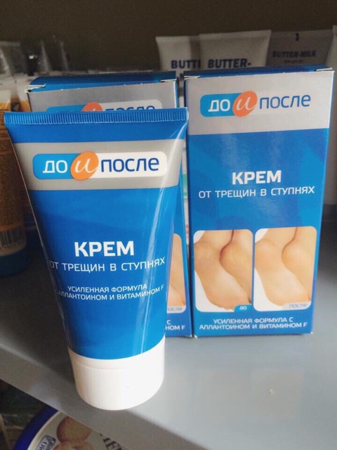 Kem nứt gót chân kpem