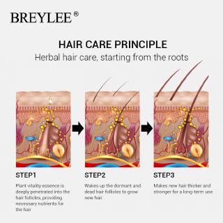 BREYLEE  2 Set Tinh dầu mọc tóc Chai Tinh Dầu Kích Mọc tóc