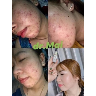 [ Chính hãng] SỮA RỬA MẶT DR MAI mẫu mới 2024