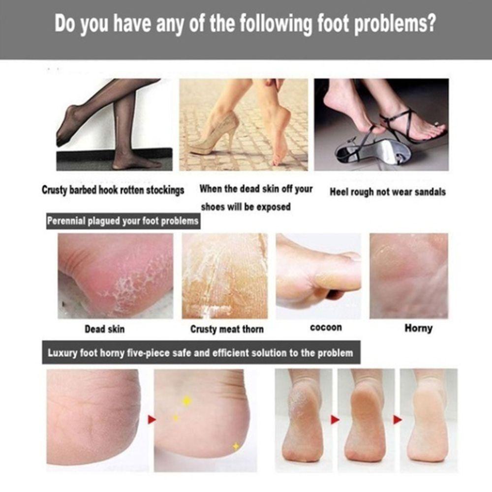 Bộ 6 / 9 / 12 Dụng Cụ Dũa Móng Chân Tẩy Tế Bào Chết Thời Trang