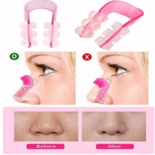 Kẹp Nâng Mũi Nose UP