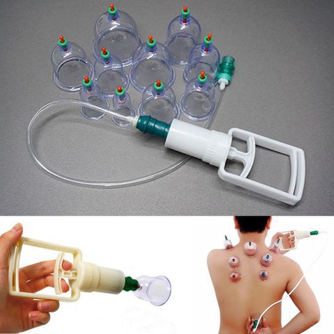 Bộ dụng cụ giác hơi 12 món không cần dùng lửa