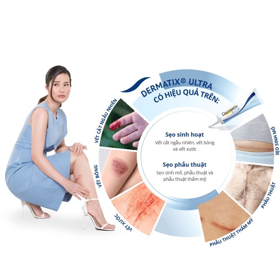 【Từ tp Hồ Chí Minh gửi hàng】kem xóa sẹo Dermatix Ultra 15g, Làm mờ sẹo chuyên sâu, an toàn, tiện lợi, dễ dàng sử dụng làm phẳng, mềm sẹo lồi, sẹo thâm, sẹo rỗ, sẹo phì đại, thấm nhanh, không cần massage, không nhờn dính - Bảo vệ khỏi tia UVA và UVB